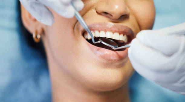 Best Emergency Dental Care for Abscessed Tooth in Springfield, NJ